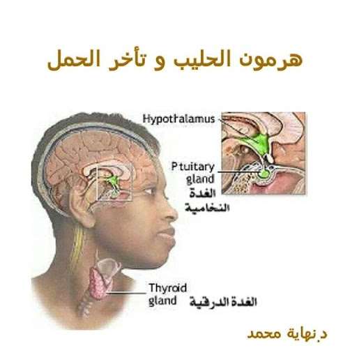 هل ارتفاع هرمون الحليب خطير - ماهي اسباب ارتفاع هرمون الحليب 1710 9