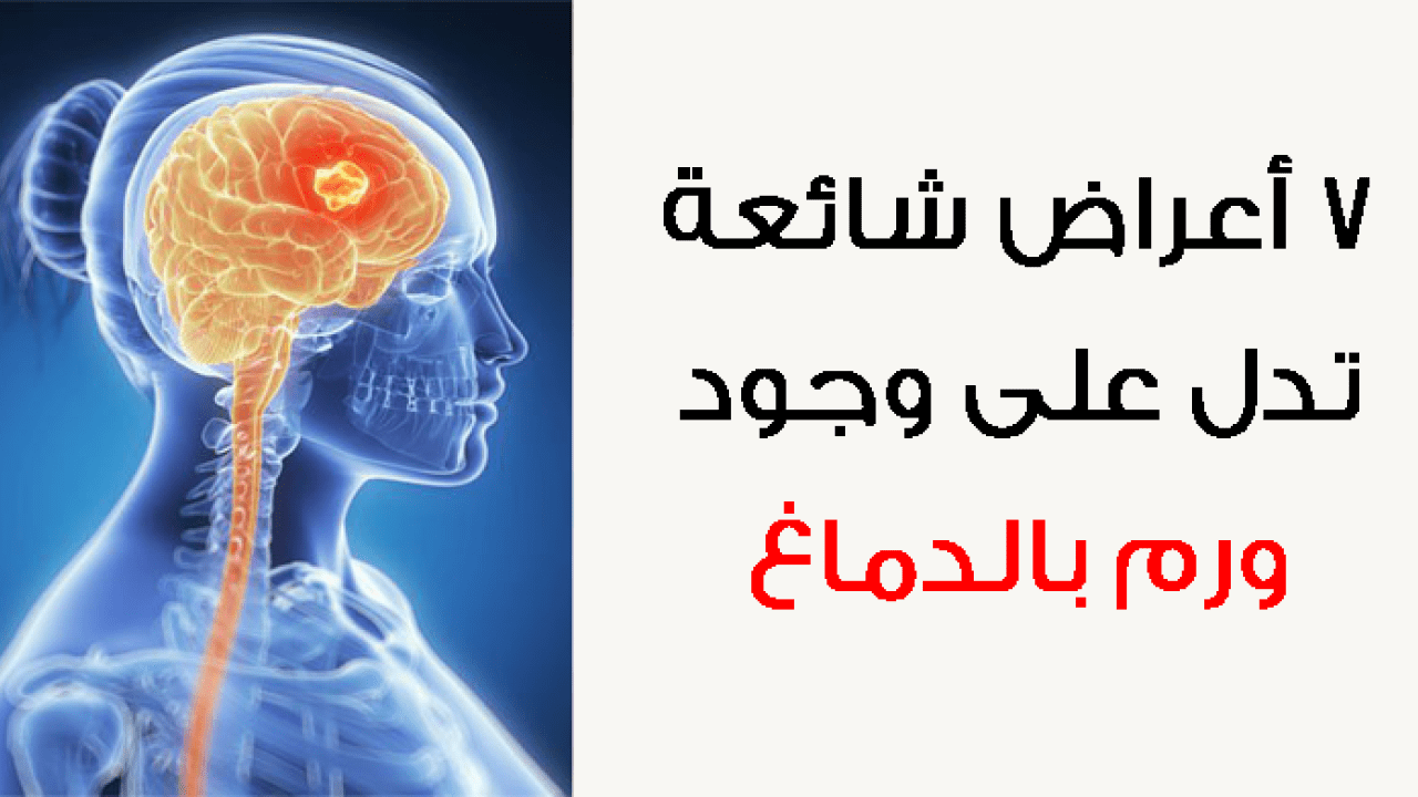 تعرف على اعراض الاصابة بمر ض سرطان المخ - اسباب سرطان الدماغ