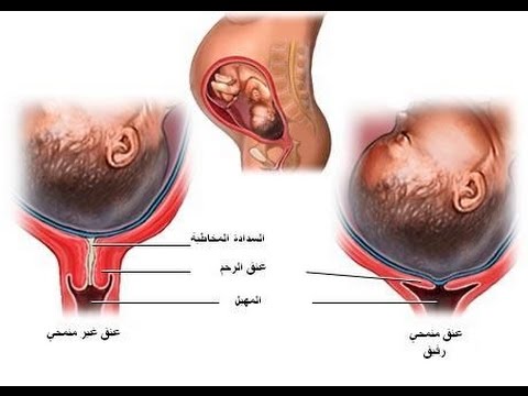 كيف اعرف طلق الولادة - علامات الطلق 3234 1