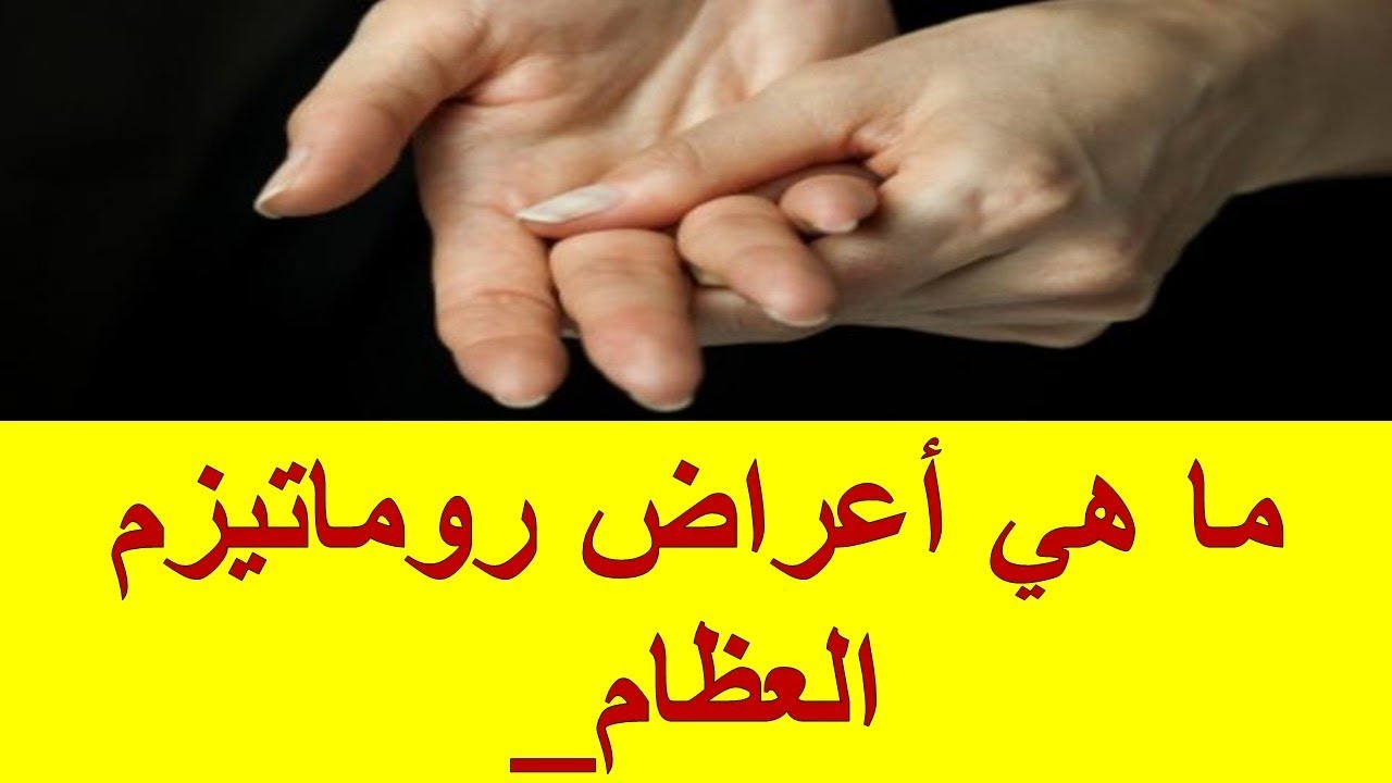 اعراض روماتيزم المفاصل , التخلص من الروماتيزم نهائيا