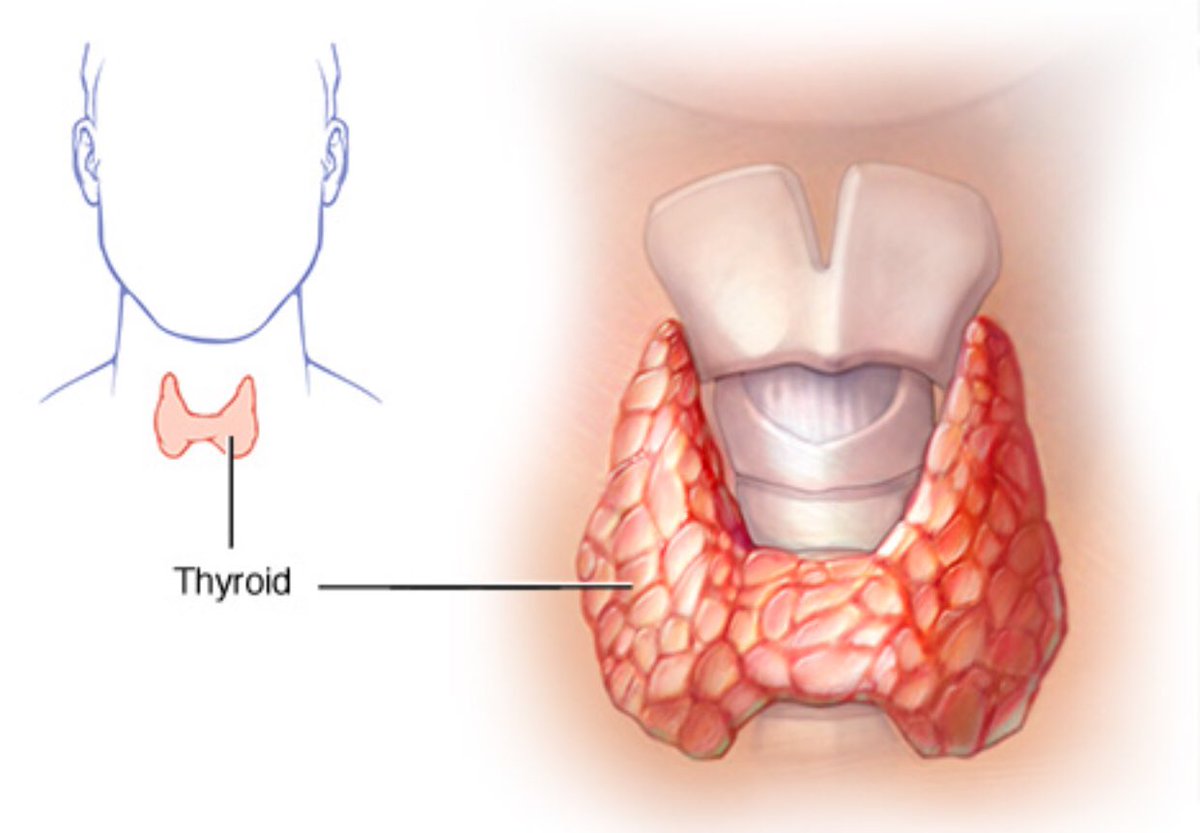 الام الغدة الدرقية - تعرف علي اضطرابات الغدة الدرقية 1478 2