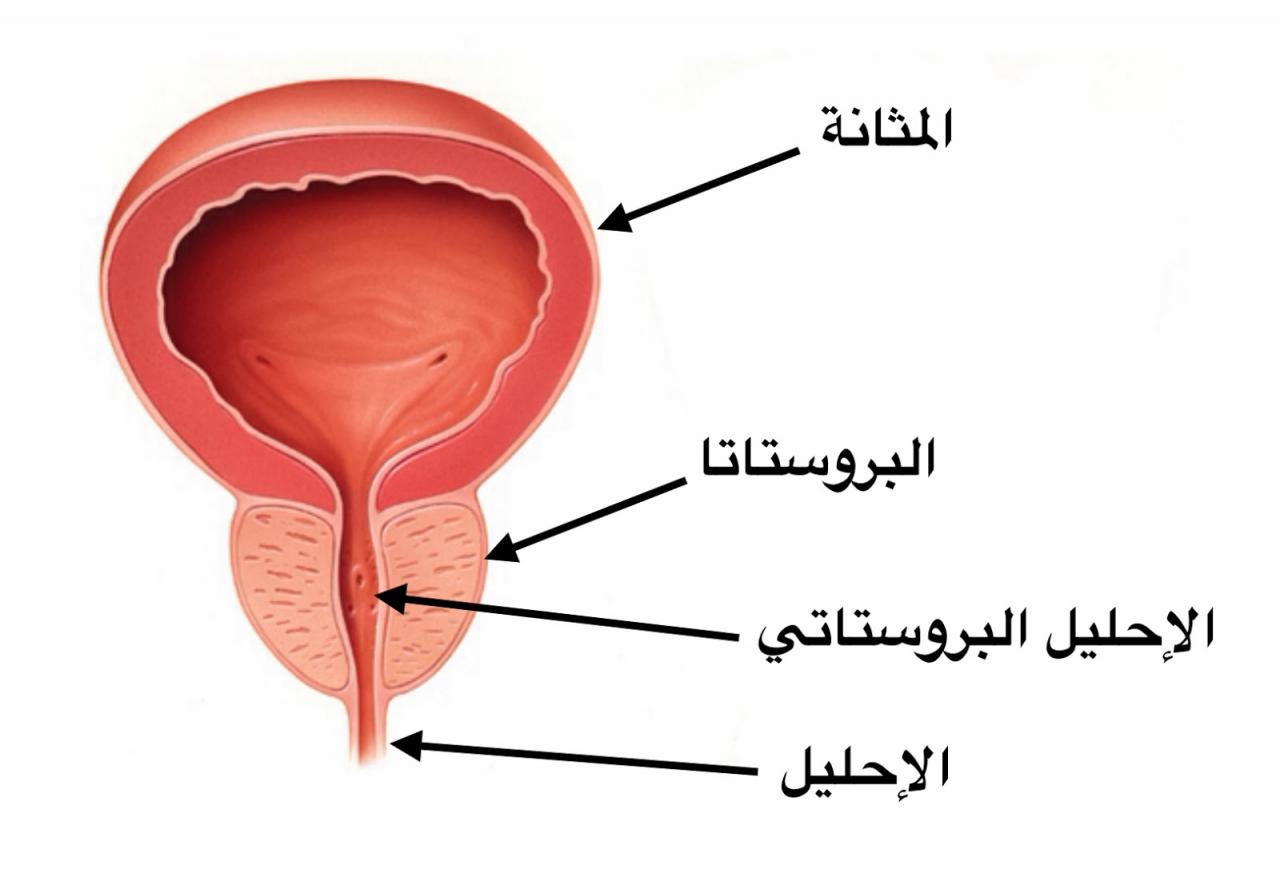 مش معقول صور لأضرار حبس التبول للسيدات-اضرار حبس البول 374 11