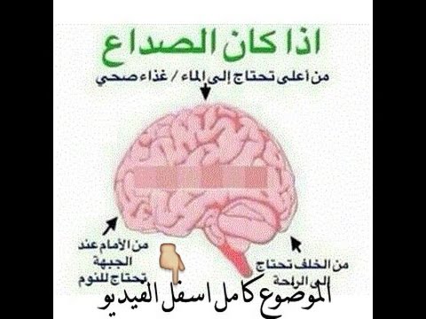 من الاعلى الراس صداع خريطة مناطق