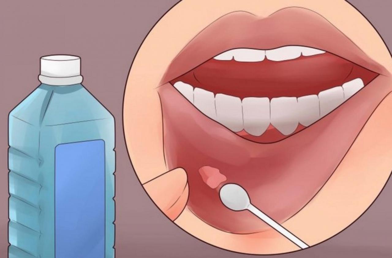 Чем можно обрабатывать рот